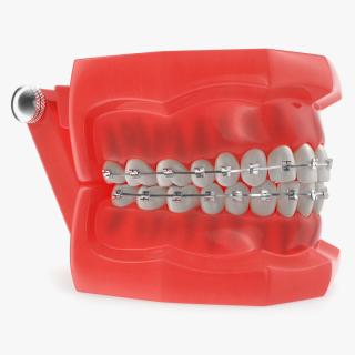 Typodont Teeth Model with Brackets 3D model