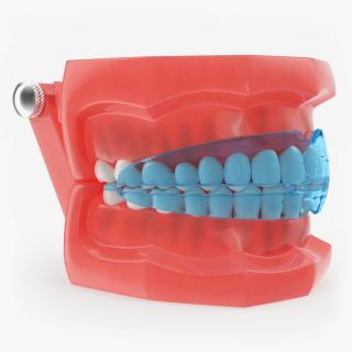 Typodont with Transparent Removable Retainer 3D model