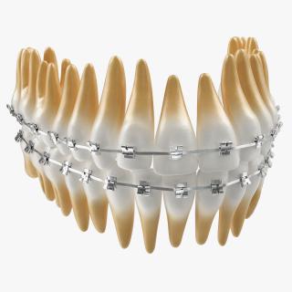 3D Teeth with Braces Model model