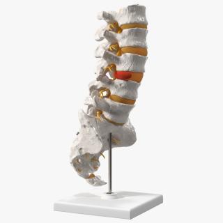 Spinal Column with Hernia on Stand 3D model