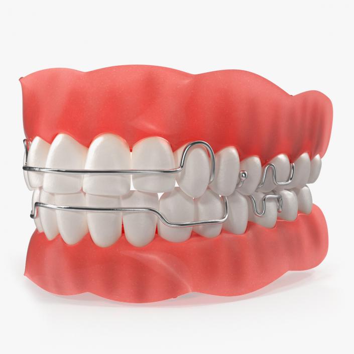 3D model Typodont Tooth Orthodontic Retainer