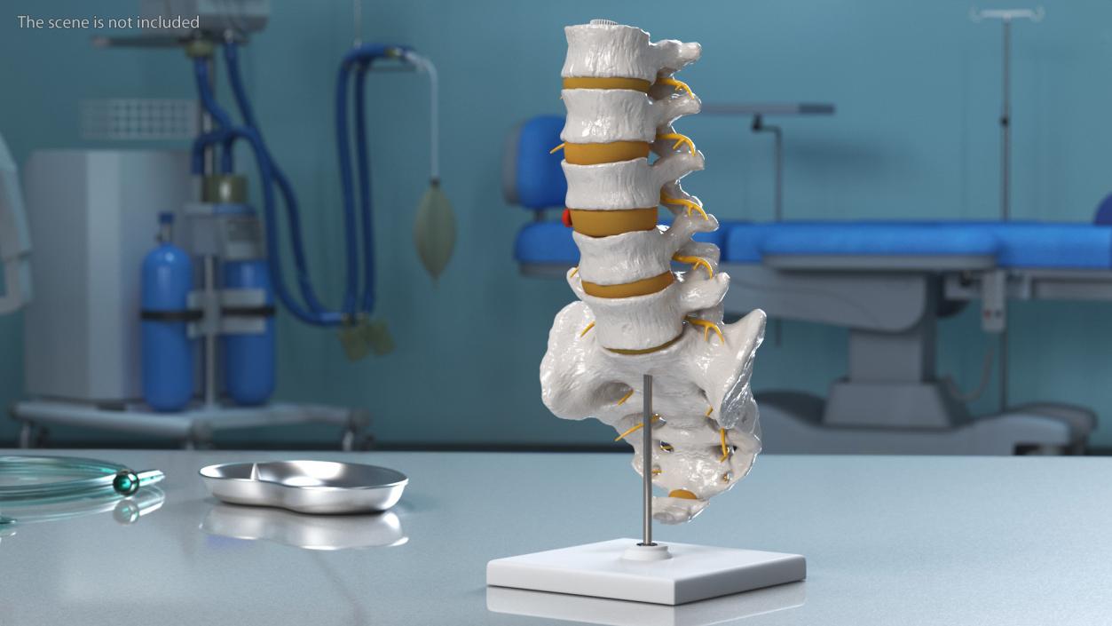 3D model Spinal Column with Hernia