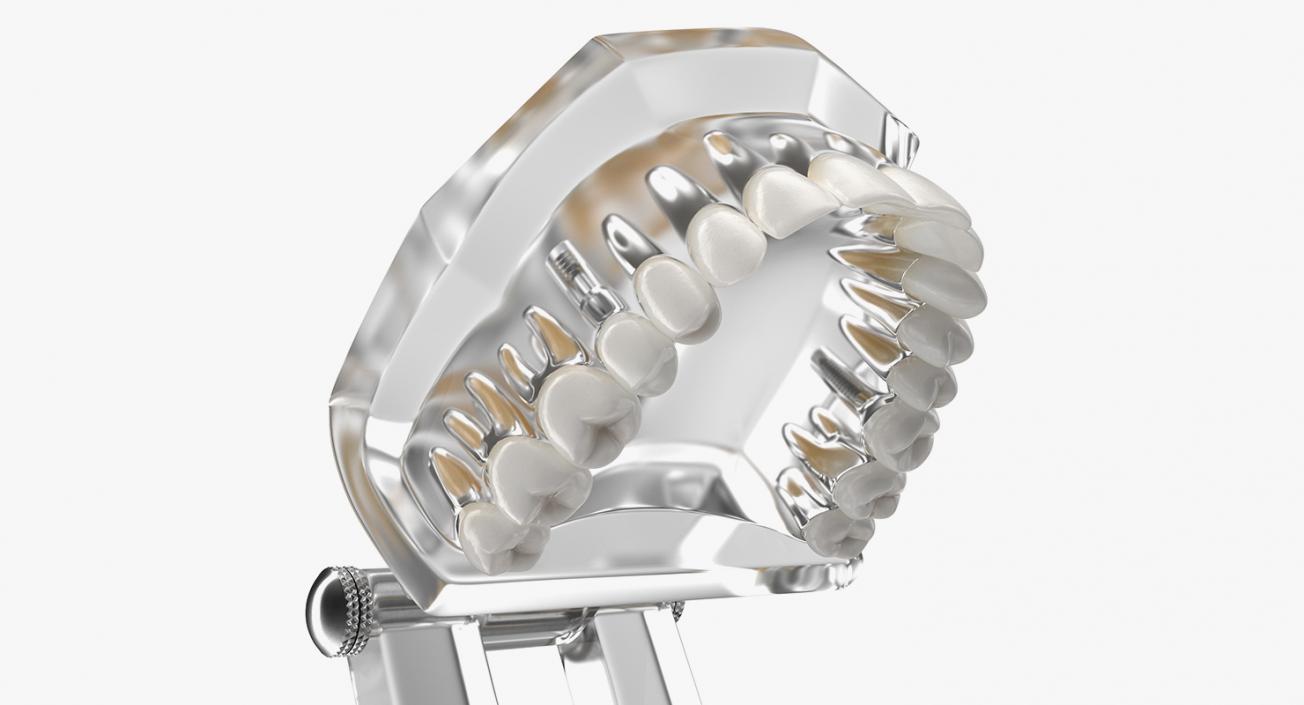 3D Transparent Dental Typodont With Dental Implants model