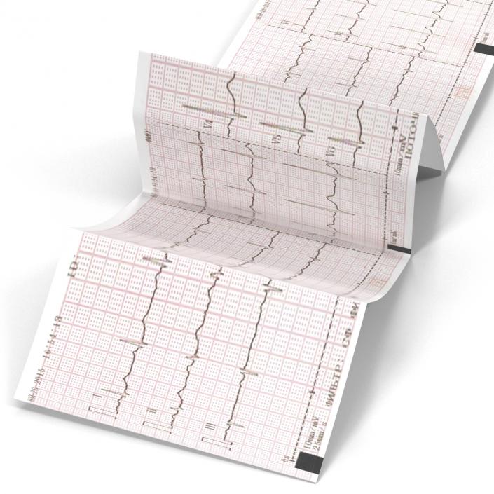 Electrocardiograph Report in Paper Form 3D model
