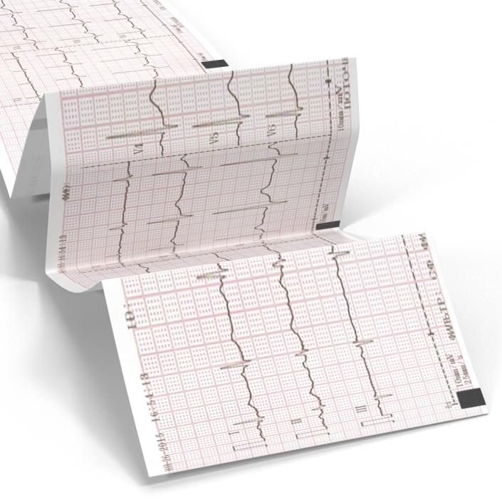 Electrocardiograph Report in Paper Form 3D model