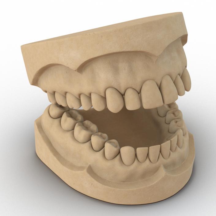 3D Dental Mold