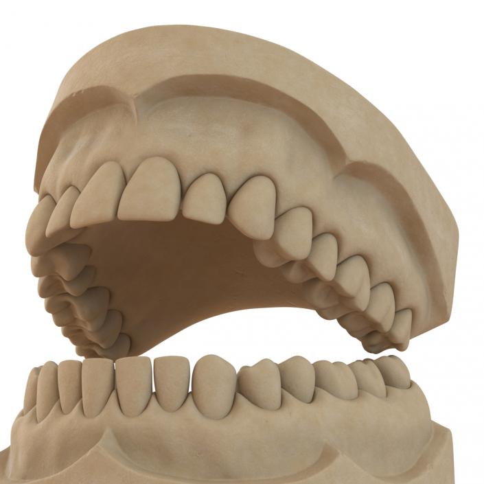 3D Dental Mold