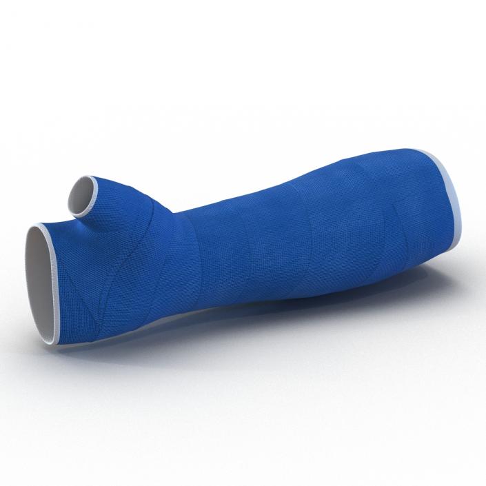 Blue Fiberglass Cast Arm 3D model