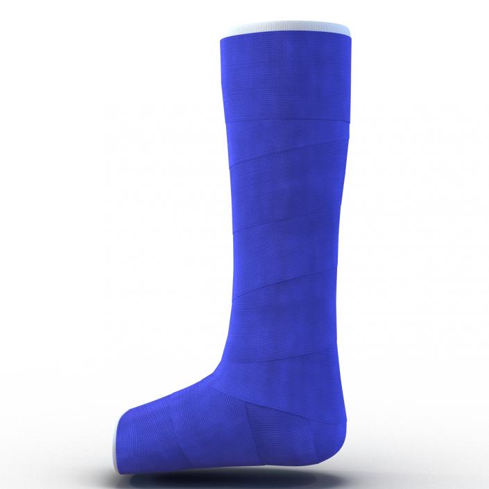 Blue Fiberglass Cast Leg 3D model