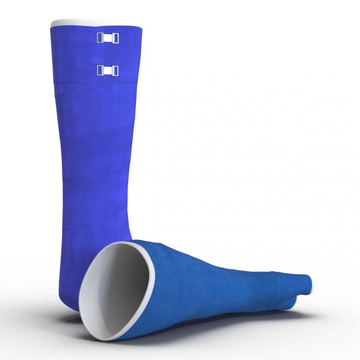 3D Blue Fiberglass Cast Arm and Leg Blue Set