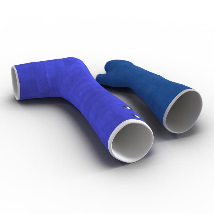3D Blue Fiberglass Cast Arm and Leg Blue Set